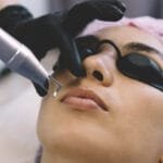 Bringen Sie Ihren Schmollmund zum Strahlen: Wie Pico Laser die Hyperpigmentierung der Lippen bekämpft