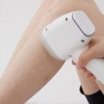 Klare Haut, keine Beulen: Mit Laser-Haarentfernung gegen Erdbeerbeine vorgehen