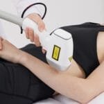 カミソリ不要の完璧な腕：レーザー脱毛の説明