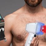 Holen Sie sich das glatte Aussehen: Ein kompletter Leitfaden zur Laser-Haarentfernung für Männer auf der Brust