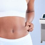 Gestalten Sie Ihre Seiten mit Laser-Lipolyse: Eine clevere Lösung, um Liebesgriffe loszuwerden