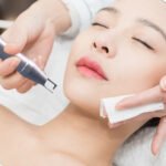 Мгновенное избавление от прыщей: как работает пикосекунда