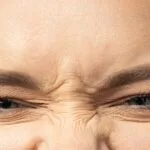 Adiós a las líneas del conejito: Guía de estética por radiofrecuencia