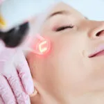 Glow Up: Kann Pico Laser Ihre Haut wirklich aufhellen?