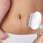 Nueva mamá, nuevo resplandor: El milagro de la piel después del bebé con radiofrecuencia