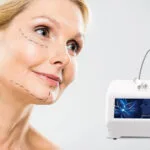 Apertar! Como a radiofrequência reafirma a pele solta