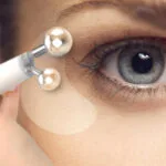 Apagar os anos: A radiofrequência reverte os pés de galinha
