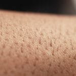 Отрастут ли волосы, если я прекращу лазерное лечение?