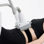 Lipólisis láser frente a liposucción: ¿Sigue siendo necesaria la cirugía?