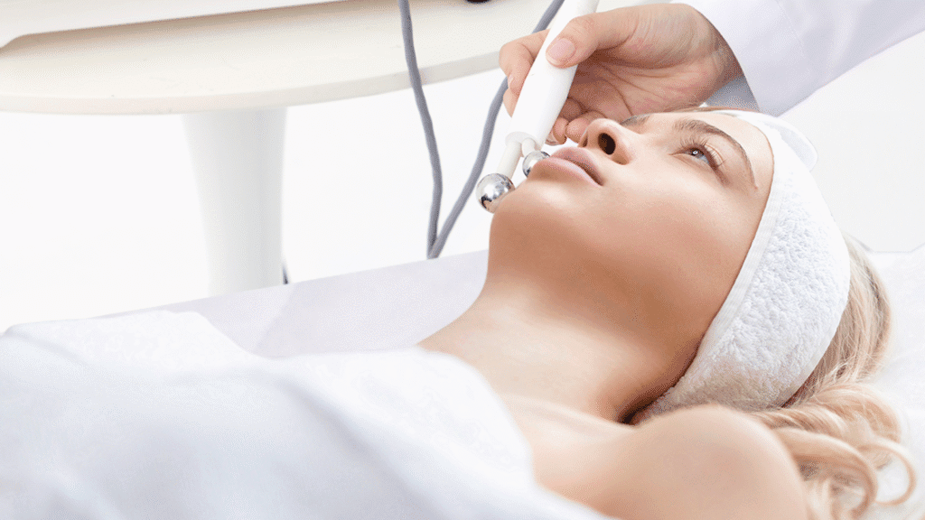 RF therapy device applied to lower face, demonstrating non-surgical reduction of marionette lines