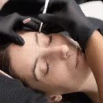 Does Pico Laser for Eyebrow Tattoo Removal Affect Your Natural Hair?