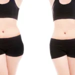 Non-Invasive Body Sculpting: Safe Fat Reduction & Contouring