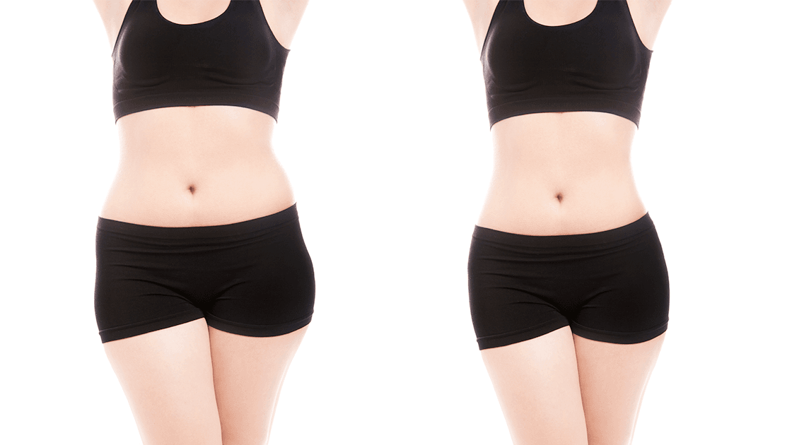 Non-Invasive Body Sculpting: Safe Fat Reduction & Contouring