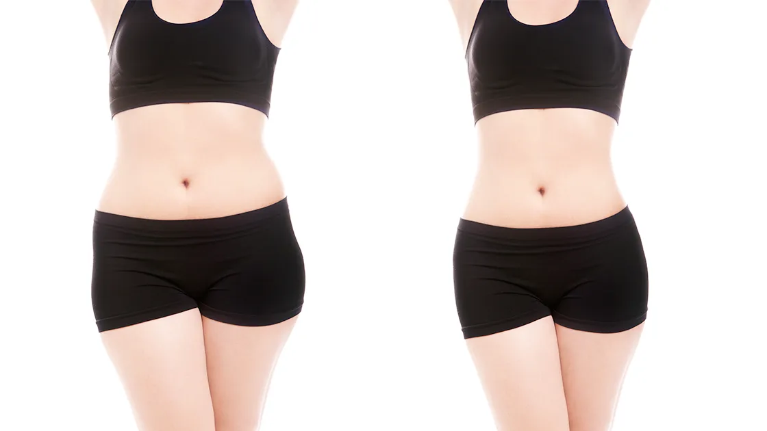 Non-Invasive Body Sculpting: Safe Fat Reduction & Contouring