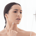 Laser Treatment Results: How Lifestyle Impacts Them