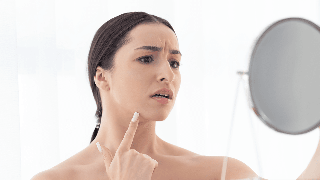 Laser Treatment Results: How Lifestyle Impacts Them