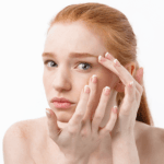 Bright Eyes Again: How Laser Therapy Can Fade Dark Circles Safely