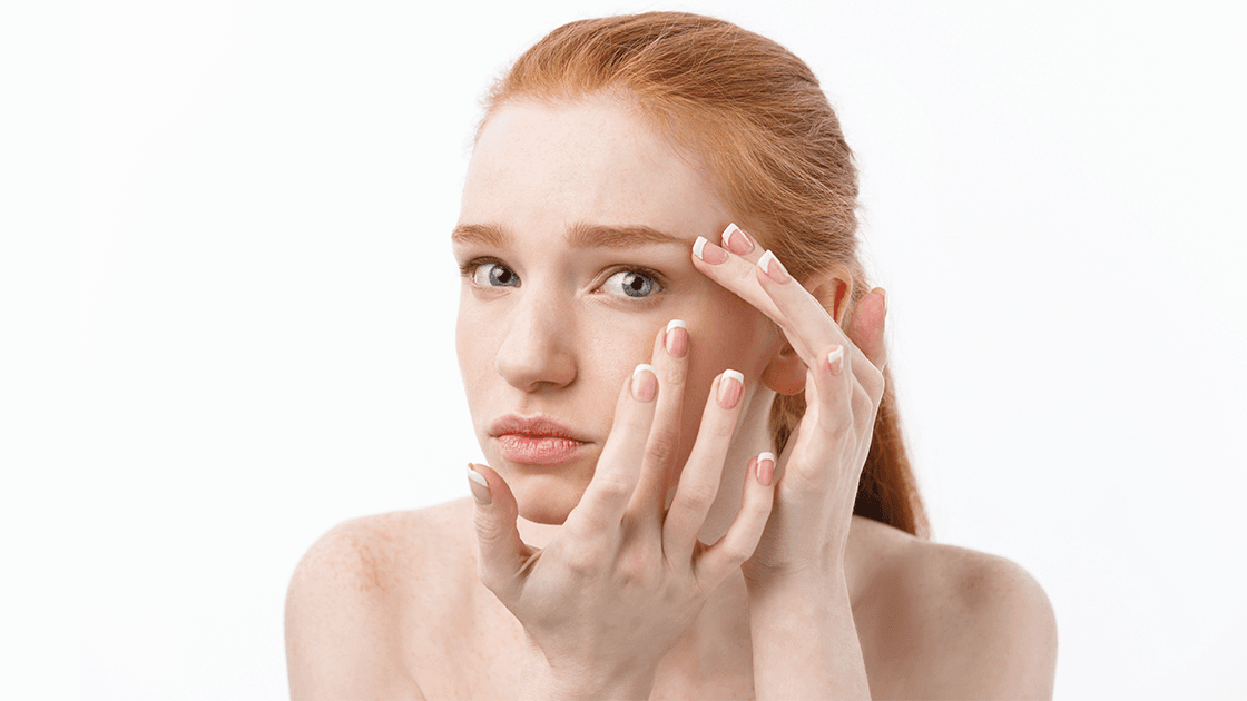 Bright Eyes Again: How Laser Therapy Can Fade Dark Circles Safely