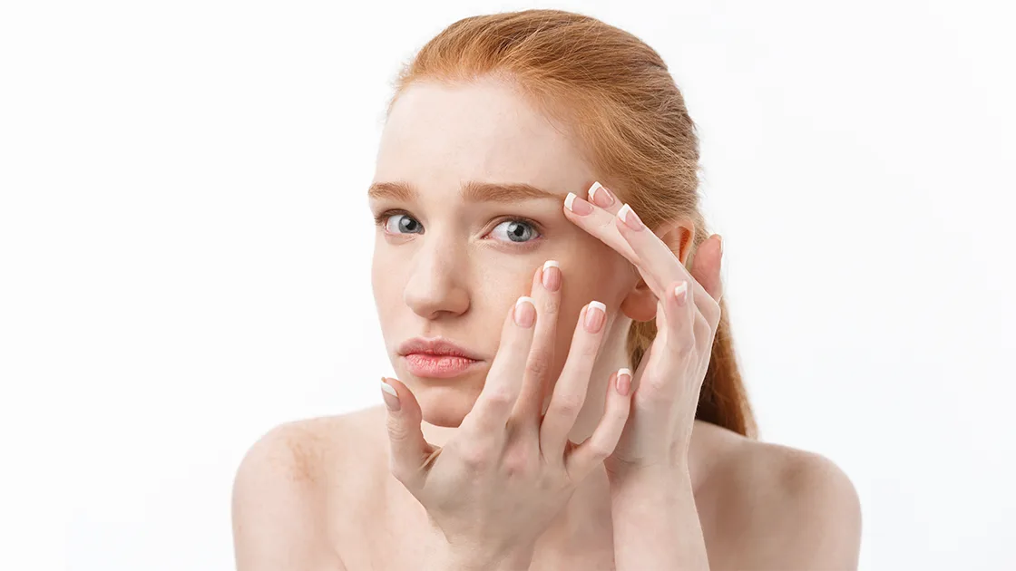 Bright Eyes Again: How Laser Therapy Can Fade Dark Circles Safely