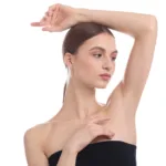 The “Chicken Skin” on My Upper Arms—How Laser Therapy Helps Women Smooth Keratosis Pilaris Without Harsh Scrubs