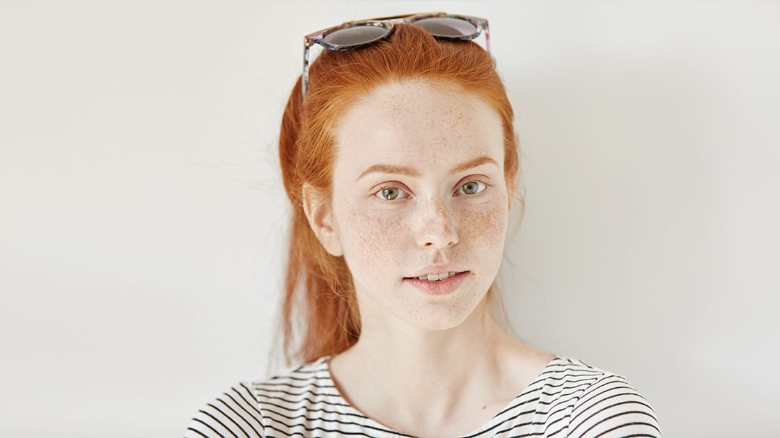 Why Postpartum Melasma Needs Laser Skin Rejuvenation