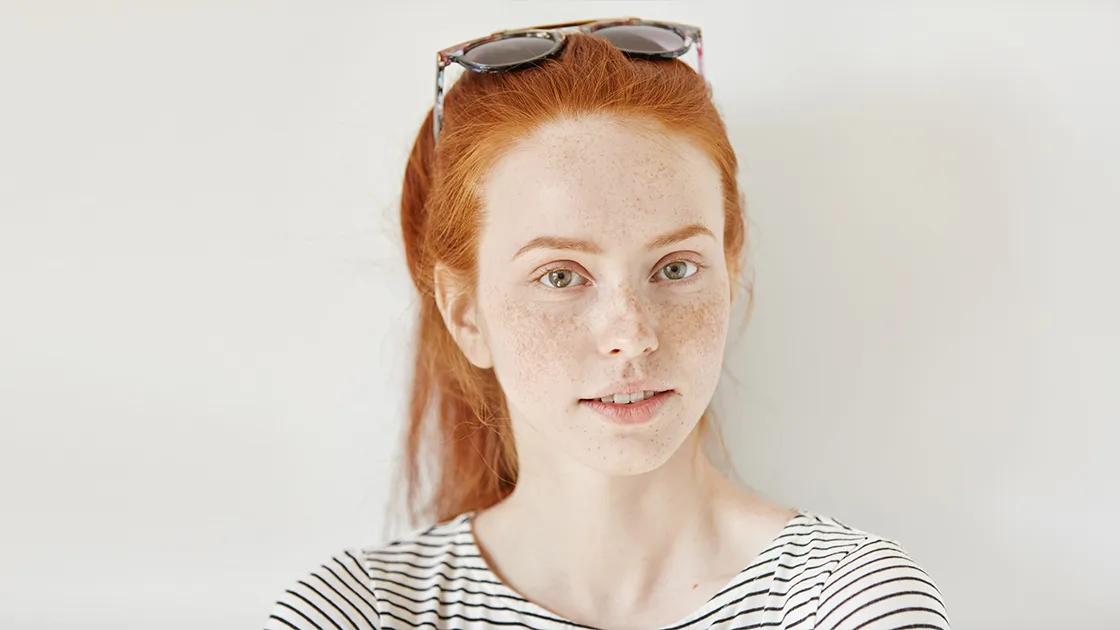 Why Postpartum Melasma Needs Laser Skin Rejuvenation
