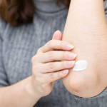 Crepey Skin on the Knees and Elbows: Non-Surgical Treatments for Smoother, Firmer-Looking Skin