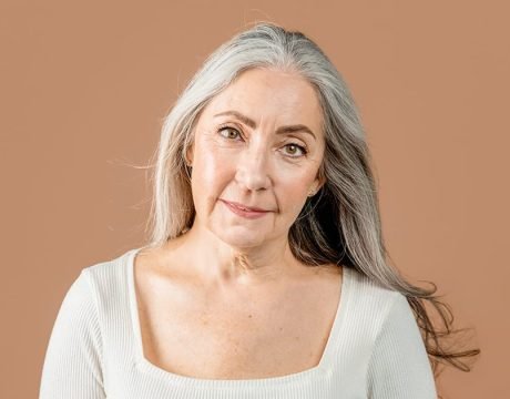 Woman showing marionette lines, illustrating need for RF therapy to restore youthful facial contours
