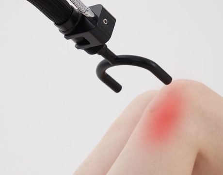Криотерапия для облегчения боли