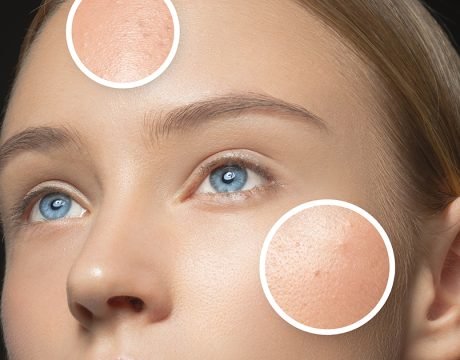 DualPico Laser Transformative Lösungen für ästhetische Praxen
