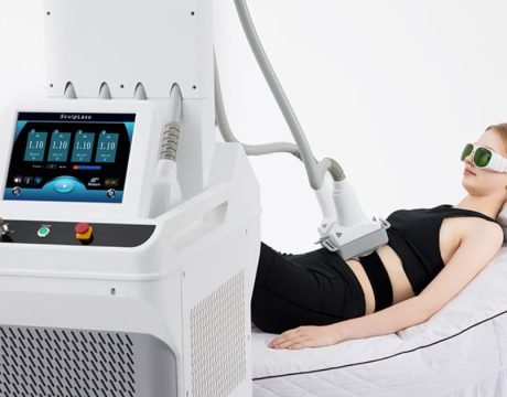 Laser Lipolysis for Belly Fat