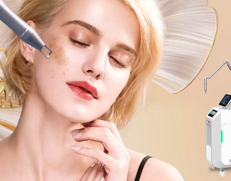 Пико лазер для лечения мелазмы