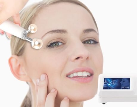 RF eyebrow lift