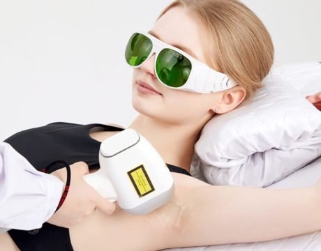 レーザー脱毛
