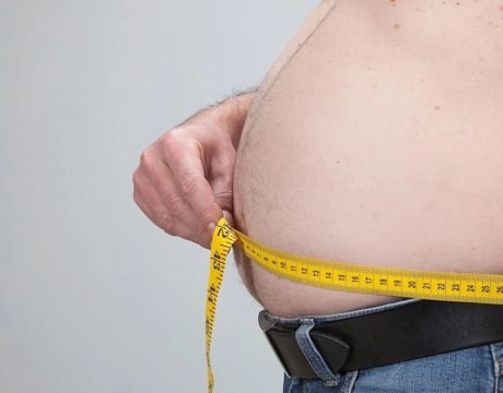 lipoaspiração a laser para a obesidade